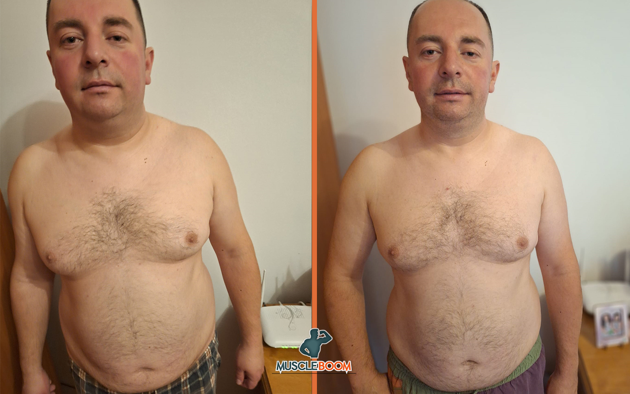 Radu-before-after-13weeks-fata
