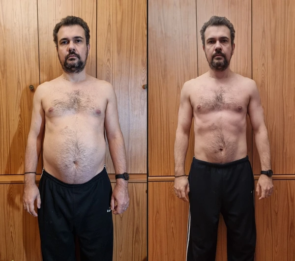 before-after fata