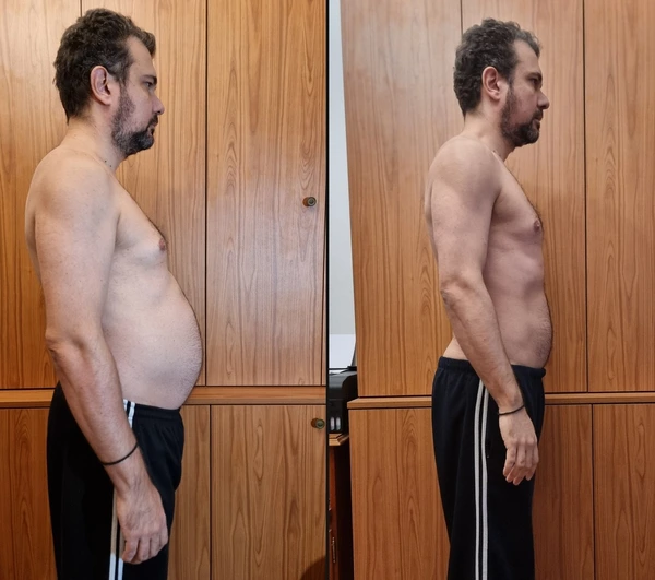 before-after lateral